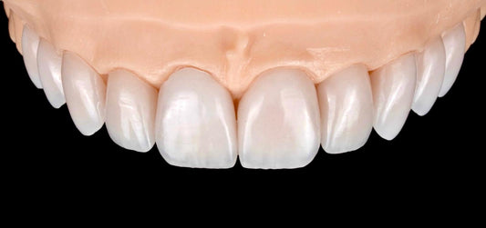 Pełny kontur Prettau3D