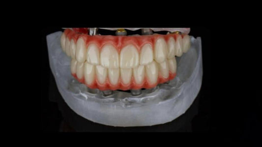 Szablon proteza all on 4/6