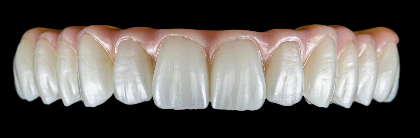 Suprastruktura - cyrkon Prettau - pełny kontur