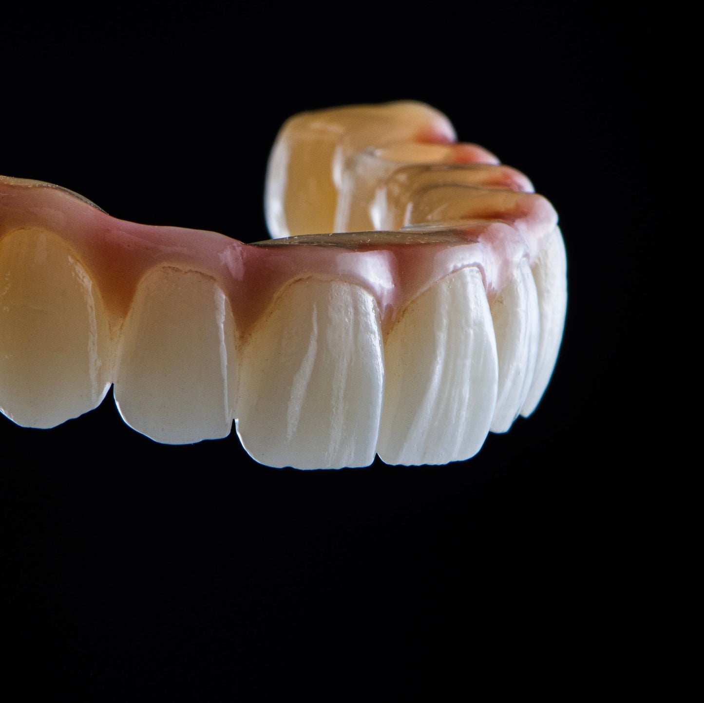 Suprastruktura - tytan/trinia/cyrkon Prettau - pełny kontur