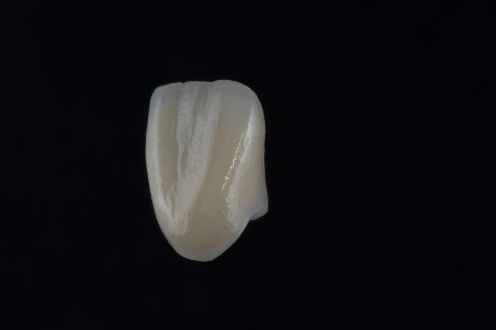 Licówka - e.max - pełny kontur