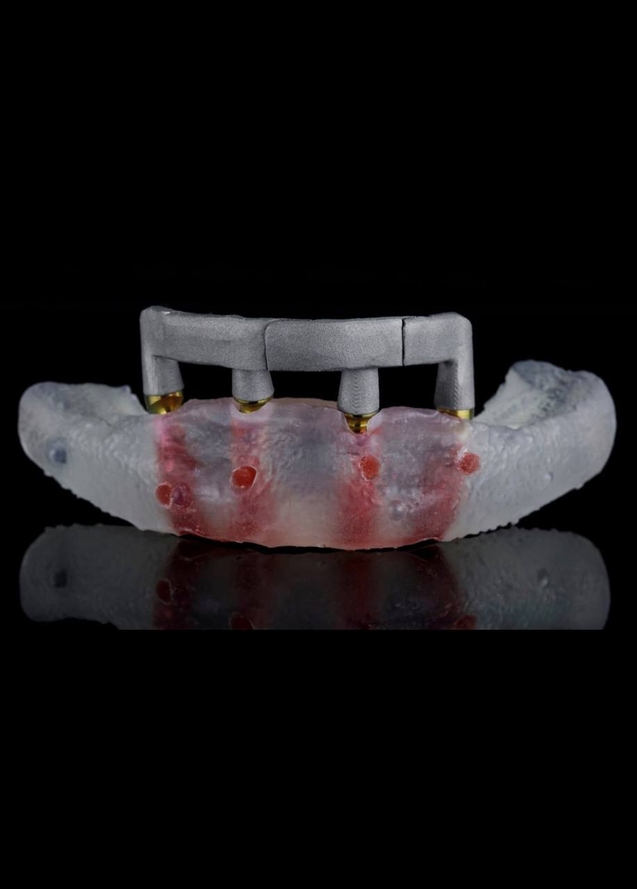 Klucz pozycyjny Metal