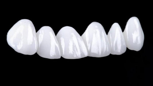 Licówka - e.max - pełny kontur